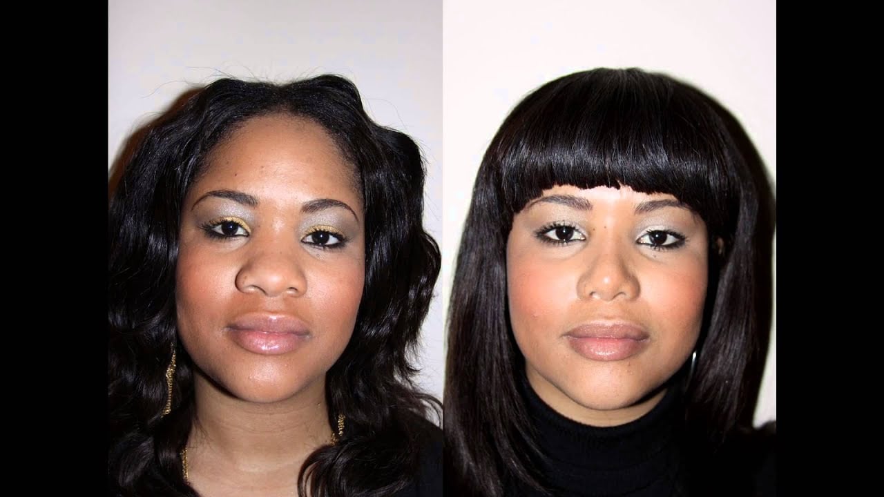 Schwarze Nasenkorrektur vor und nach der Operation