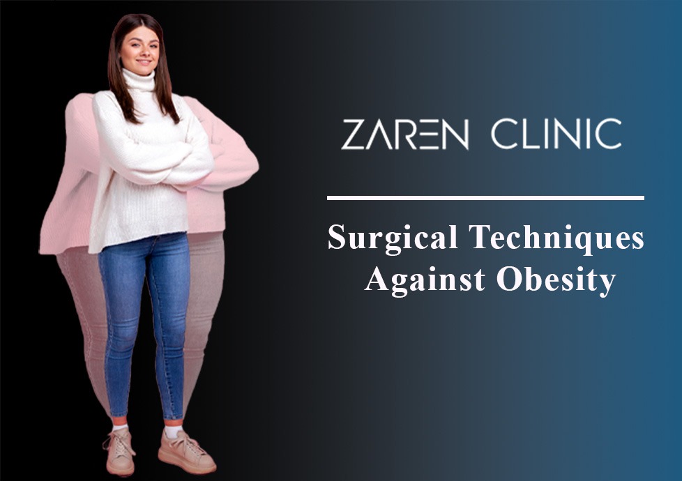 Surgical Techniques for Obesity
