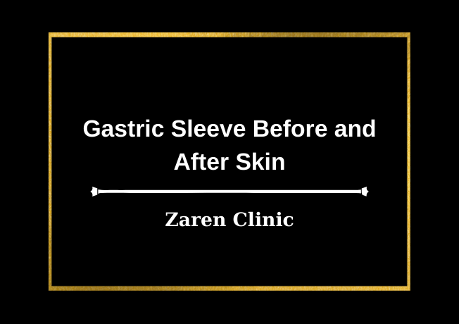Gastric Sleeve Before and After Skin