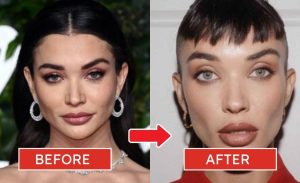 amy_jackson_plastic_surgery