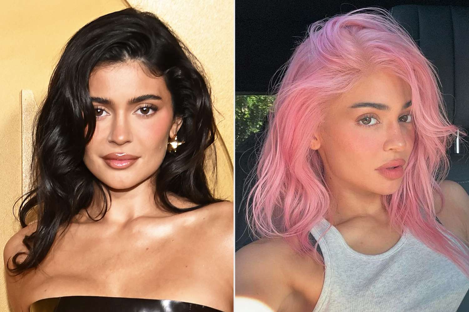 Kylie Jenner prije i poslije: Putovanje plastične kirurgije