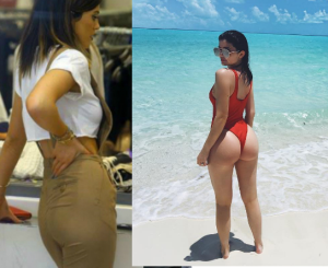 Antes e depois da bunda de Kylie Jenner