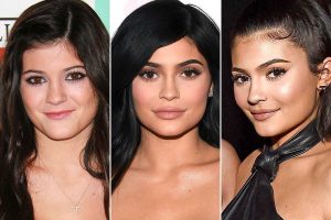Foto de labios antes y después de Kylie Jenner