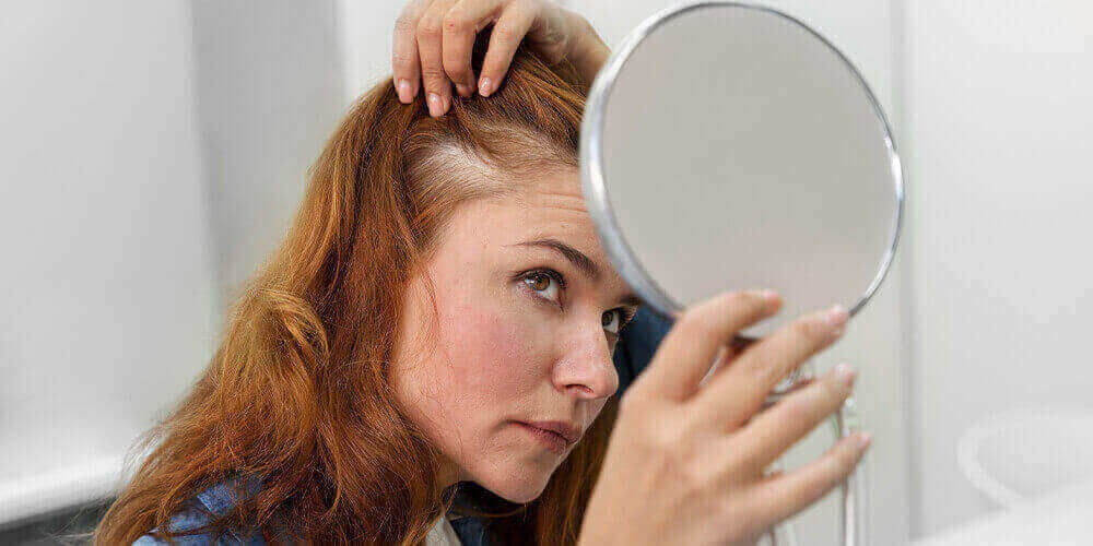 Classification de la chute des cheveux chez la femme : aperçu de l'échelle de Ludwig