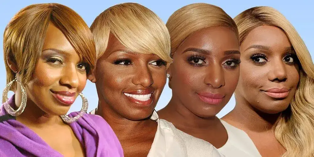 Prominente, die sich einer Schönheitsoperation unterzogen haben