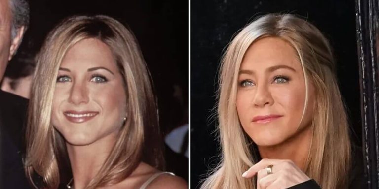 Jennifer Aniston Plastic Surgery Before And After And All Changes