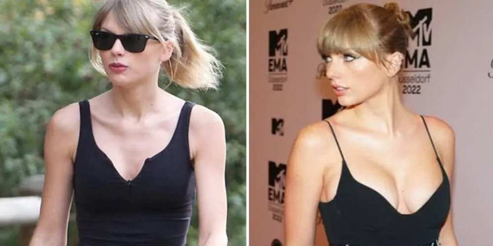 Taylor Swift Breast Implants After Appearance - Zaren Health