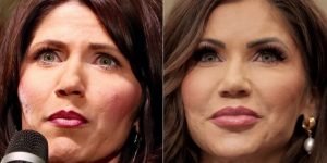 Did Kristi Noem Have Plastic Surgery? Before and After Analysis - Zaren