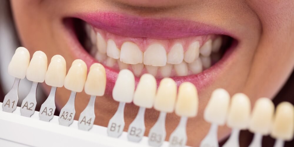 Zirconium Veneers in Turkey