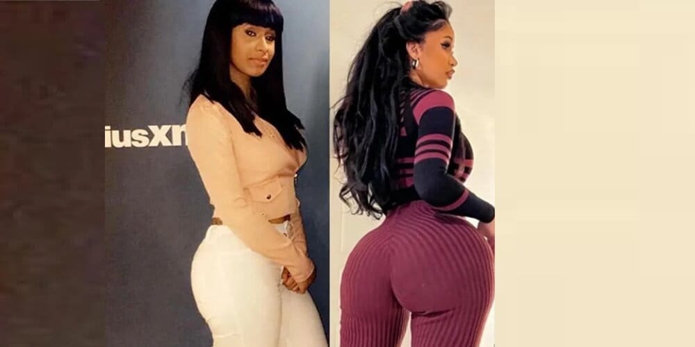Quelles interventions esthétiques Cardi B a-t-elle subies ? BBL, rhinoplastie, facettes dentaires et plus encore expliquées.