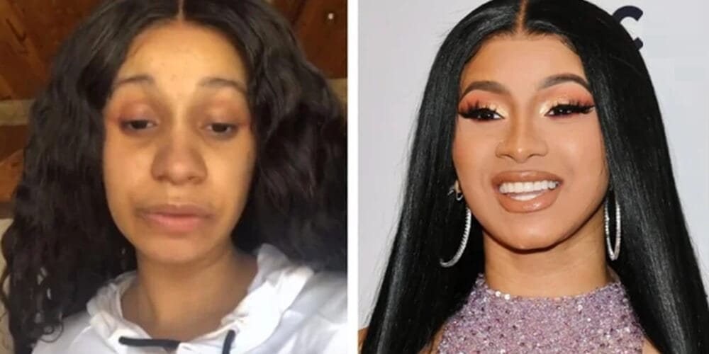 Quelles interventions esthétiques Cardi B a-t-elle subies ? BBL, rhinoplastie, facettes dentaires et plus encore expliquées.