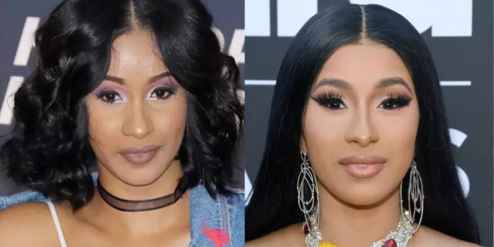 Quelles interventions esthétiques Cardi B a-t-elle subies ? BBL, rhinoplastie, facettes dentaires et plus encore expliquées.
