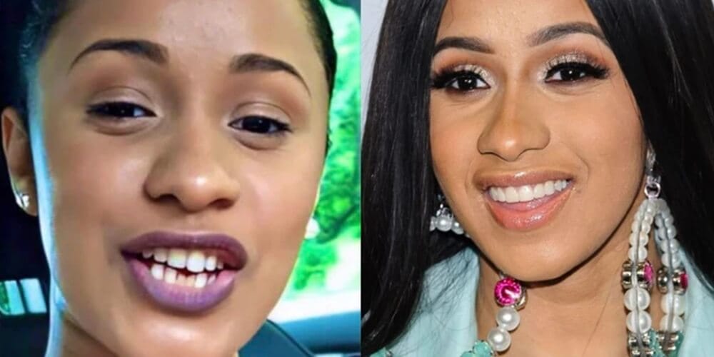 Quelles interventions esthétiques Cardi B a-t-elle subies ? BBL, rhinoplastie, facettes dentaires et plus encore expliquées.