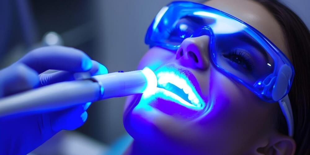 Trattamenti dentali laser in Turchia per una cura odontoiatrica moderna
