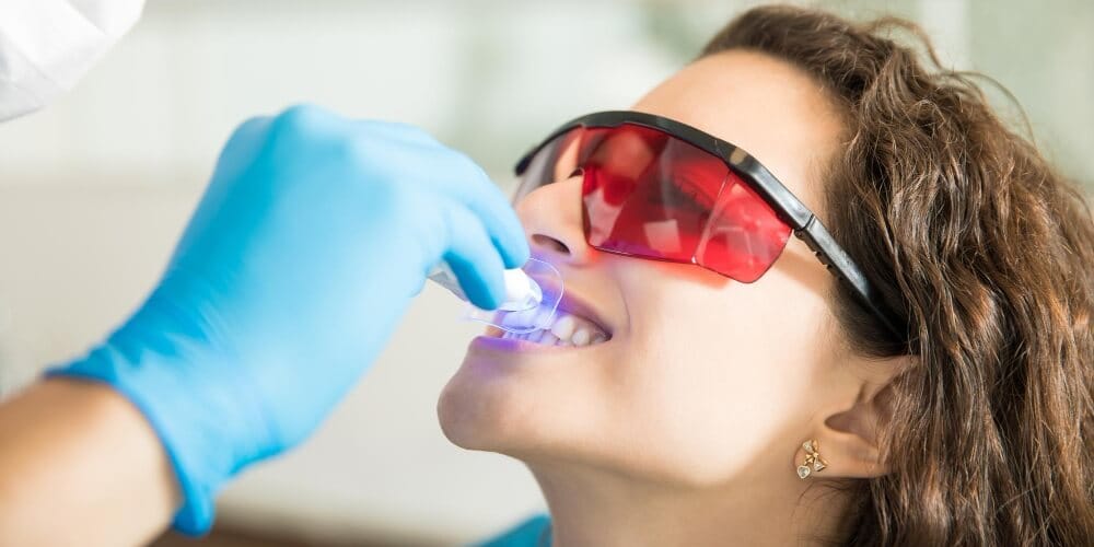 Trattamenti dentali laser in Turchia per una cura odontoiatrica moderna