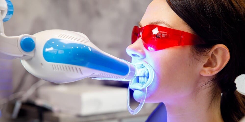 Trattamenti dentali laser in Turchia per una cura odontoiatrica moderna