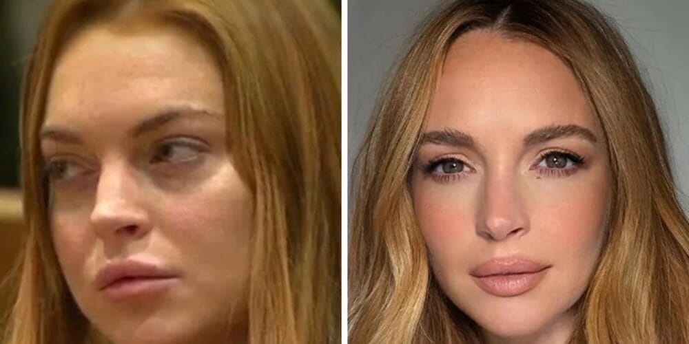 La trasformazione di Lindsay Lohan: cosa c’è dietro il suo aspetto giovanile?