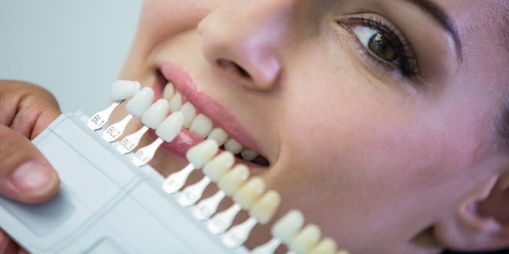 Hollywood Smile vs Zirconium Crowns: Which Is Better for You?
