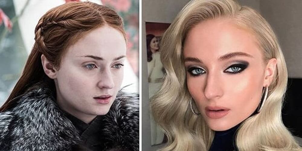 La trasformazione del viso di Sophie Turner: affermazioni cosmetiche e fatti
