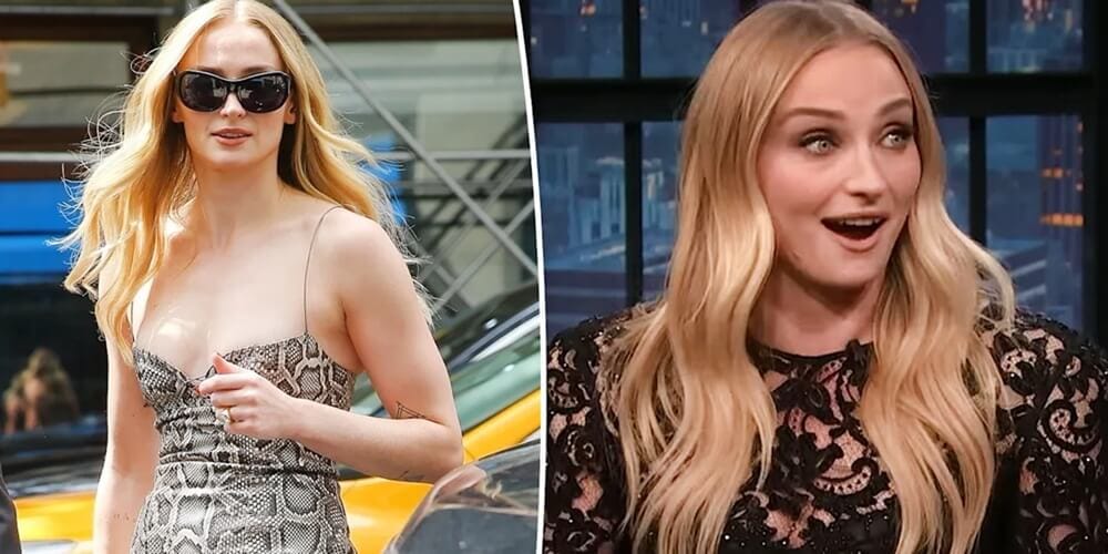 La trasformazione del viso di Sophie Turner: affermazioni cosmetiche e fatti