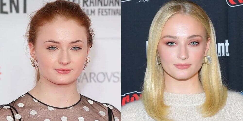 La trasformazione del viso di Sophie Turner: affermazioni cosmetiche e fatti