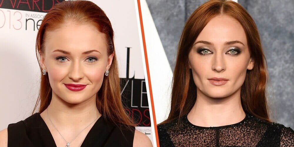 La trasformazione del viso di Sophie Turner: affermazioni cosmetiche e fatti