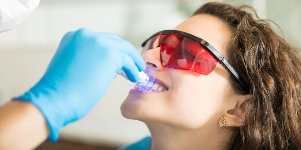 Professional Teeth Whitening in Türkiye for Stained Teeth