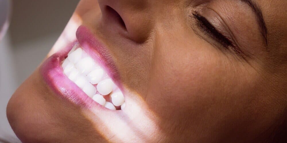 Professional Teeth Whitening in Türkiye for Stained Teeth